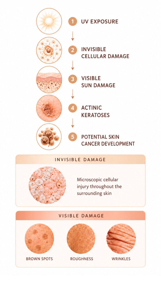 Skin Cancer Prevention St Petersburg